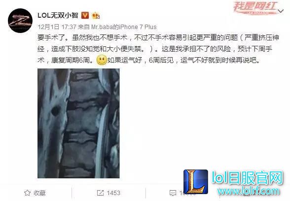 小智:直播生涯已无遗憾