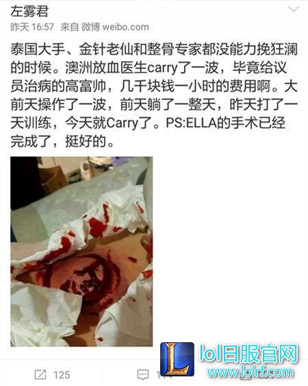90%选手都有健康隐患 几年后职业病会爆发？